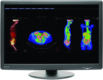 Image: The Dome GX4MP radiology display (Photo courtesy of NDS Surgical Display).